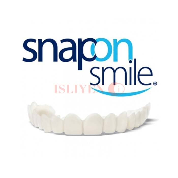 Snap-On Smile veneer